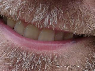 My dad's lovely teeth