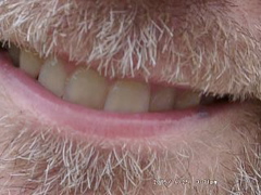My dad's lovely teeth